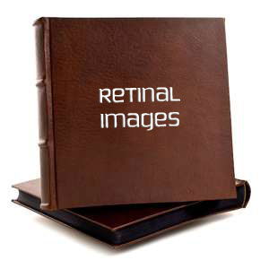 retinal images